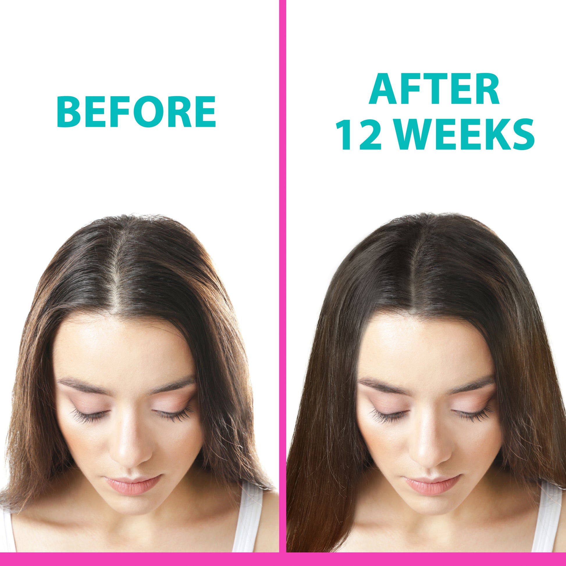 Before and after results using Hair Growth Serum – visible improvement after 12 weeks.